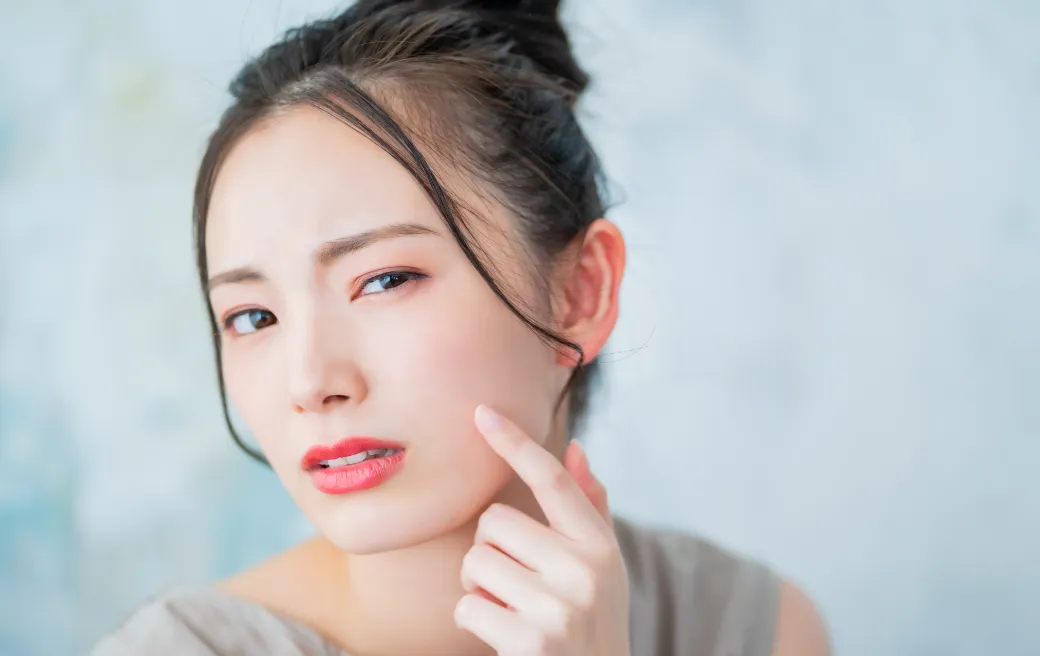 なかなか治らないニキビ・ニキビ跡のお悩みに